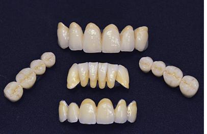 TEETHlowres